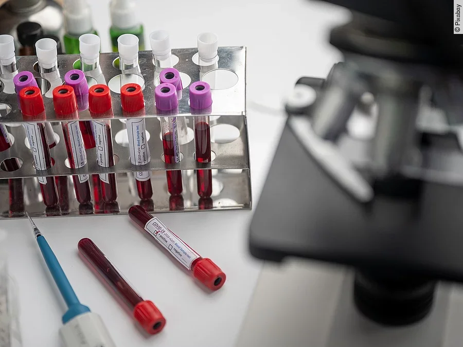 Blutprobe
