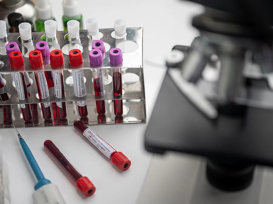 Blutprobe