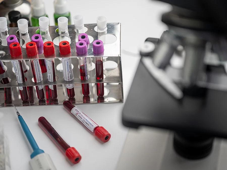 Blutprobe