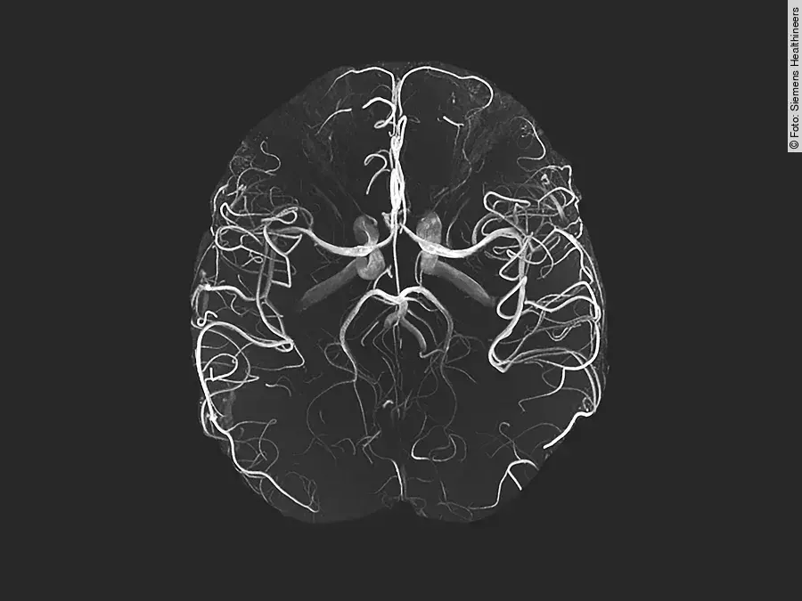 MRT Magnetom Terra Siemens