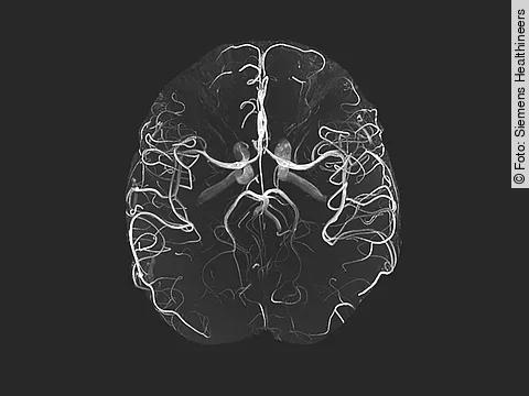 MRT Magnetom Terra Siemens