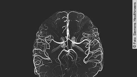 MRT Magnetom Terra Siemens MRT Magnetom Terra Siemens
