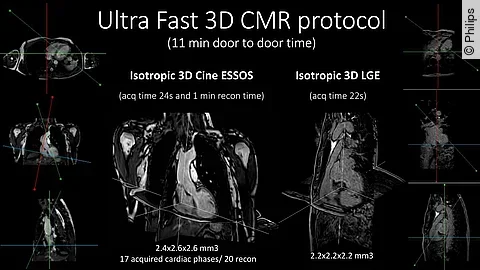 Philips_Forschungsprojekt_CNIC_Juli-2021_Bild1