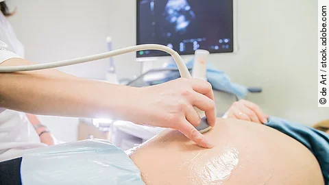 Schwangerschaft Schwangerschaft