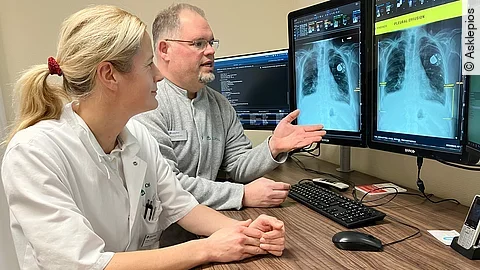 KI in der Radiologie bei Asklepios