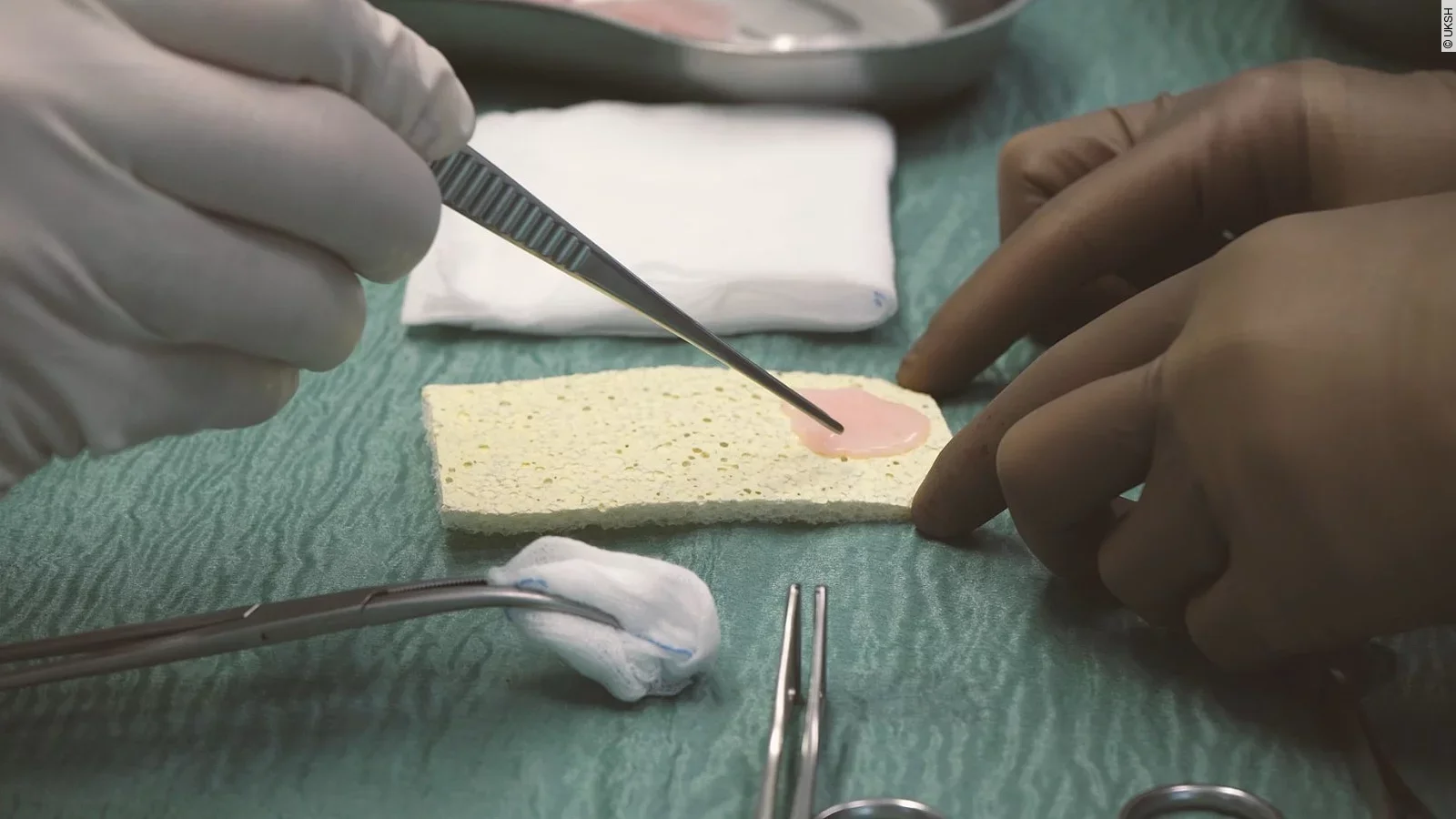 Herzpflaster Implantation OP