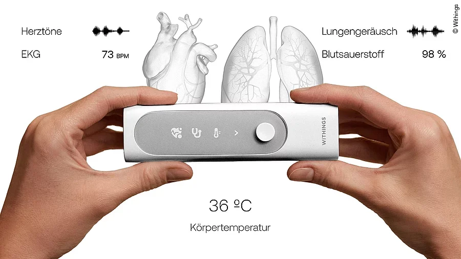 BeamO Messwerte BeamO Messwerte