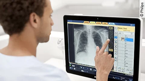 Philips Radiology Smart Assistant