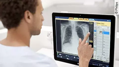 Philips Radiology Smart Assistant