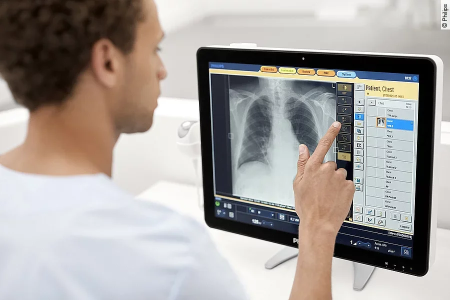 Philips Radiology Smart Assistant Philips Radiology Smart Assistant