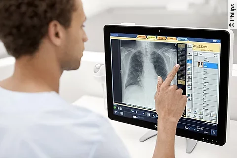 Philips Radiology Smart Assistant