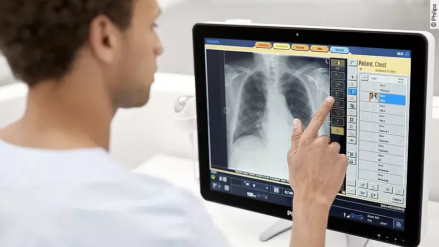 Philips DigitalDiagnost C90 ELEVA Touchscreen Philips DigitalDiagnost C90 ELEVA Touchscreen