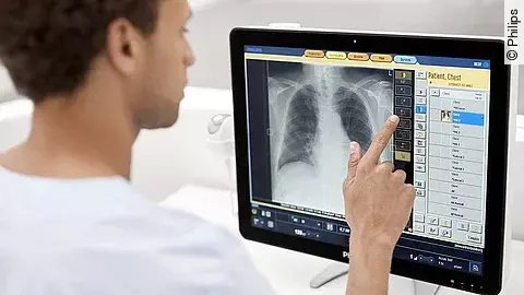Philips DigitalDiagnost C90 ELEVA Touchscreen