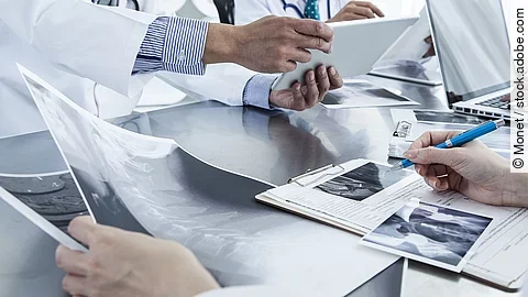 Ärzte im Gespräch mit Röntgenaufnahmen und anderen Dokumenten.