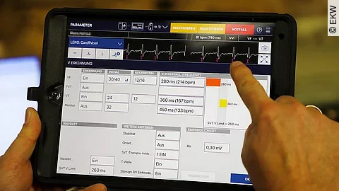 Herz-Daten auf dem Tablet