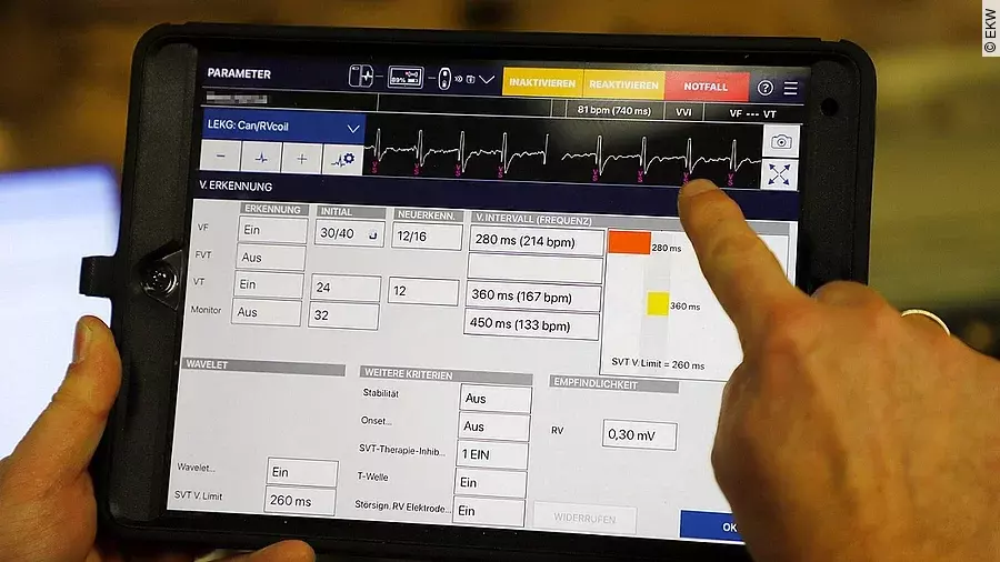 Herz-Daten auf dem Tablet