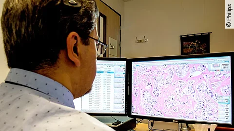 Philips_Pathologie Partnerschaft Marienhospital_Juli 2021_Bild 1