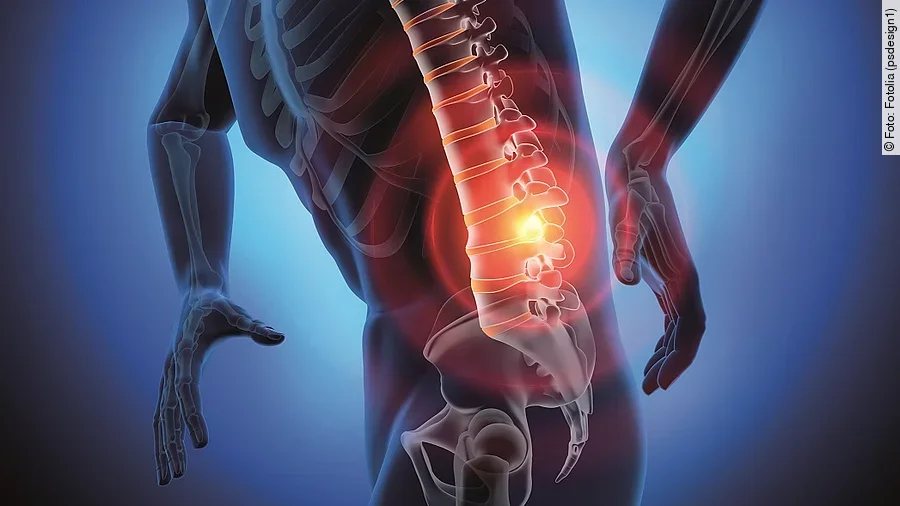Rückenschmerzen