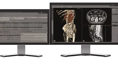 Monitor mit PACS Monitor mit PACS