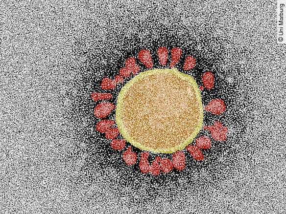 SARS-CoV-2-Partikel SARS-CoV-2-Partikel