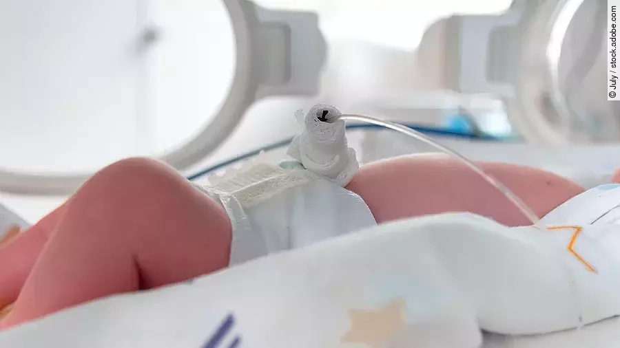 Baby, das in einem Inkubator liegt. 