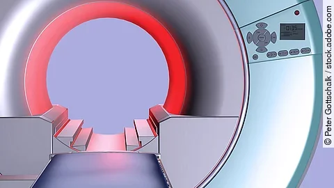 Ein frontaler Blick auf das innere eines Computertomographen (CT).