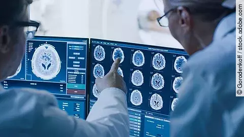 Zwei Ärzte schauen auf Monitore mit Röntgenbildern