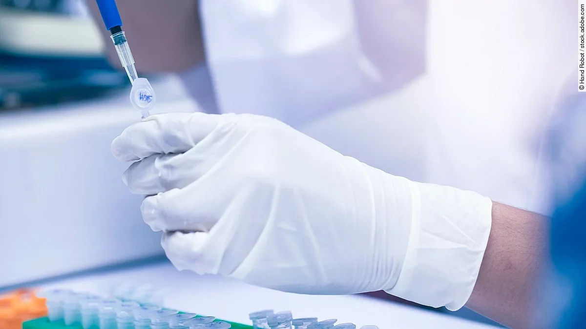 Im Labor wird eine Probe untersucht