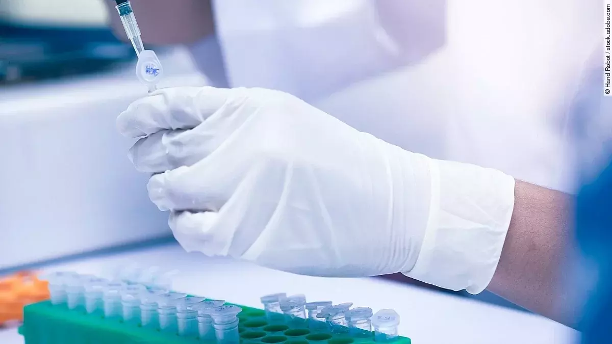 Im Labor wird eine Probe untersucht