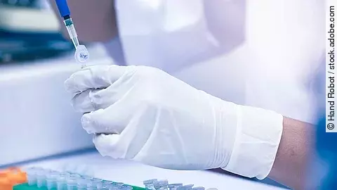 Im Labor wird eine Probe untersucht