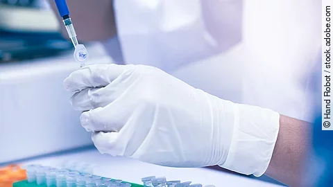 Im Labor wird eine Probe untersucht