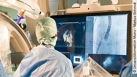 Pascal Ace Herzklappen-Reparatursystem Pascal Ace Herzklappen-Reparatursystem