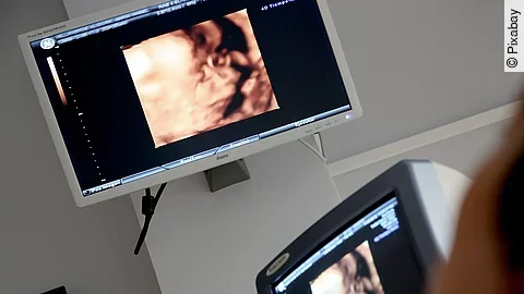 Ultraschall Ultraschall