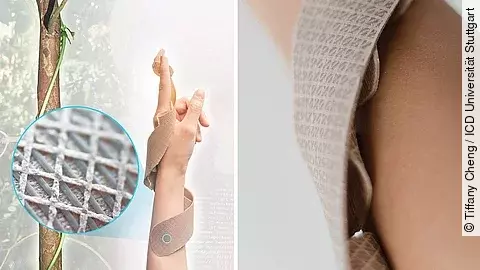 3D-gedruckter Prototyp einer Unterarmschiene 3D-gedruckter Prototyp einer Unterarmschiene