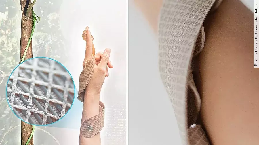 3D-gedruckter Prototyp einer Unterarmschiene 3D-gedruckter Prototyp einer Unterarmschiene