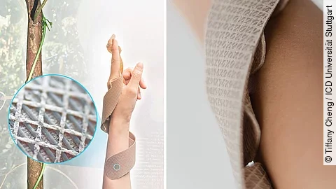 3D-gedruckter Prototyp einer Unterarmschiene