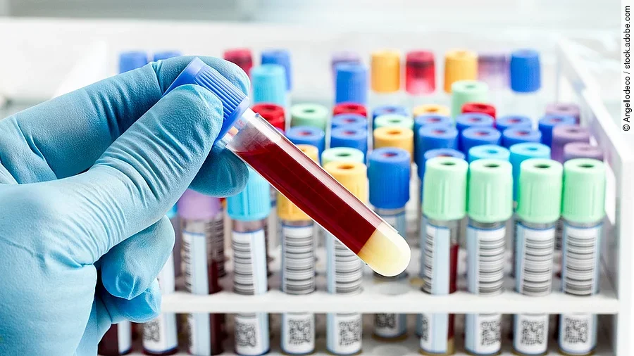 Blutprobe Blutprobe