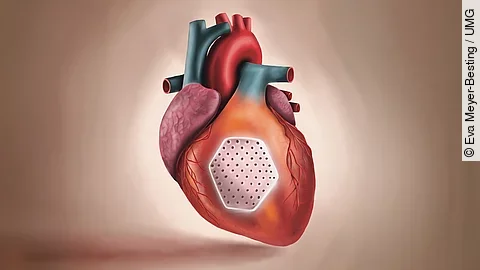 3D-Herzpflaster 3D-Herzpflaster