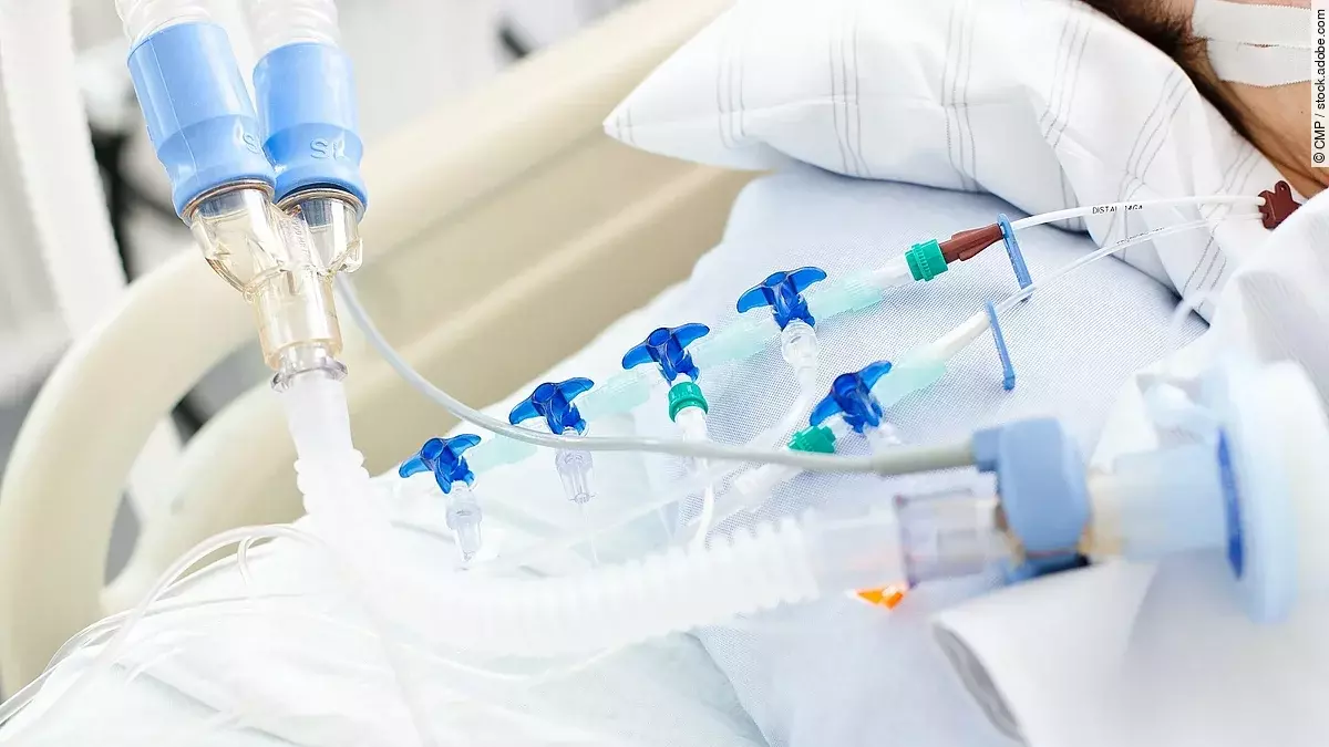 Beatmungsgerät Beatmungsgerät