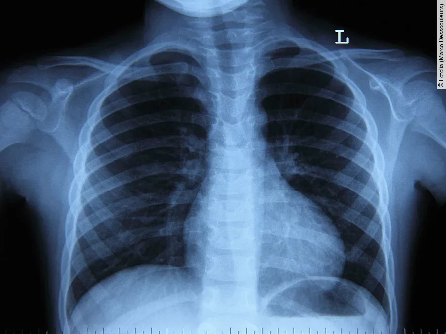 Radiologie Radiologie