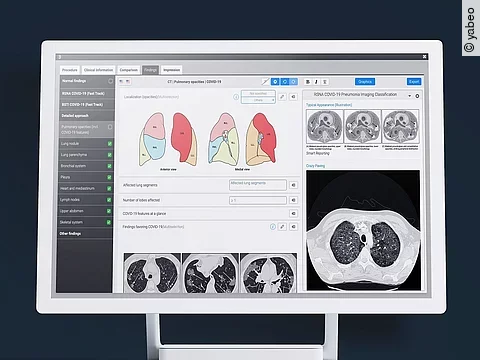 COVID-19-Template von Smart Reporting