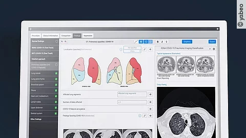 COVID-19-Template von Smart Reporting