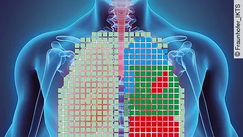 Hightech-Weste überwacht die Lungenfunktionen Hightech-Weste überwacht die Lungenfunktionen