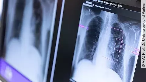 AI Rad Companion Monitor AI Rad Companion Monitor