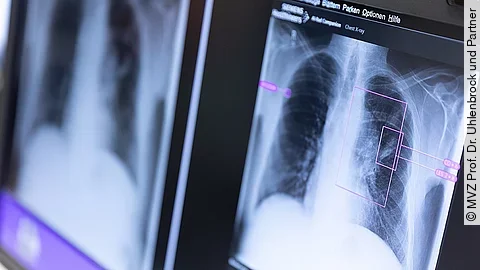 AI Rad Companion Monitor