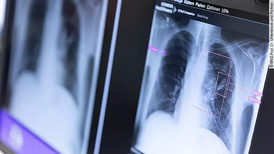 AI Rad Companion Monitor