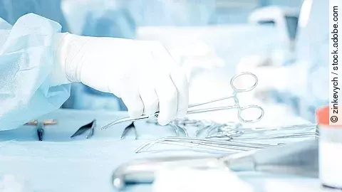 Chiurgie Hand greift nach OP-Schere, die auf einem Tisch mit weiterem OP-Besteck liegt.