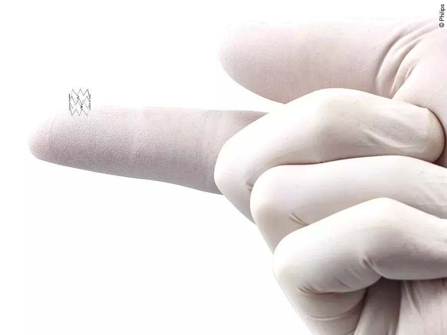 Intact Vascular Tack Endovascular System