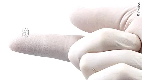 Intact Vascular Tack Endovascular System